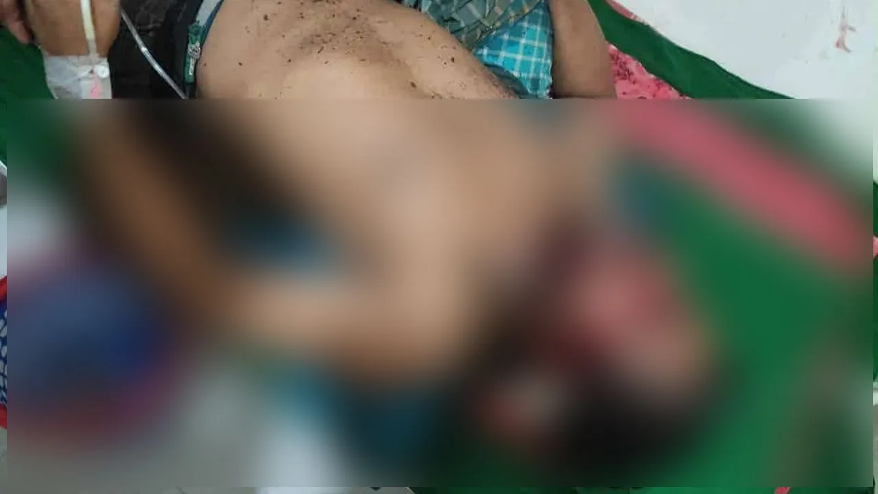 বেতাগীতে ছিনতাইয়ের শিকার বিকাশ ব্যবসায়ী