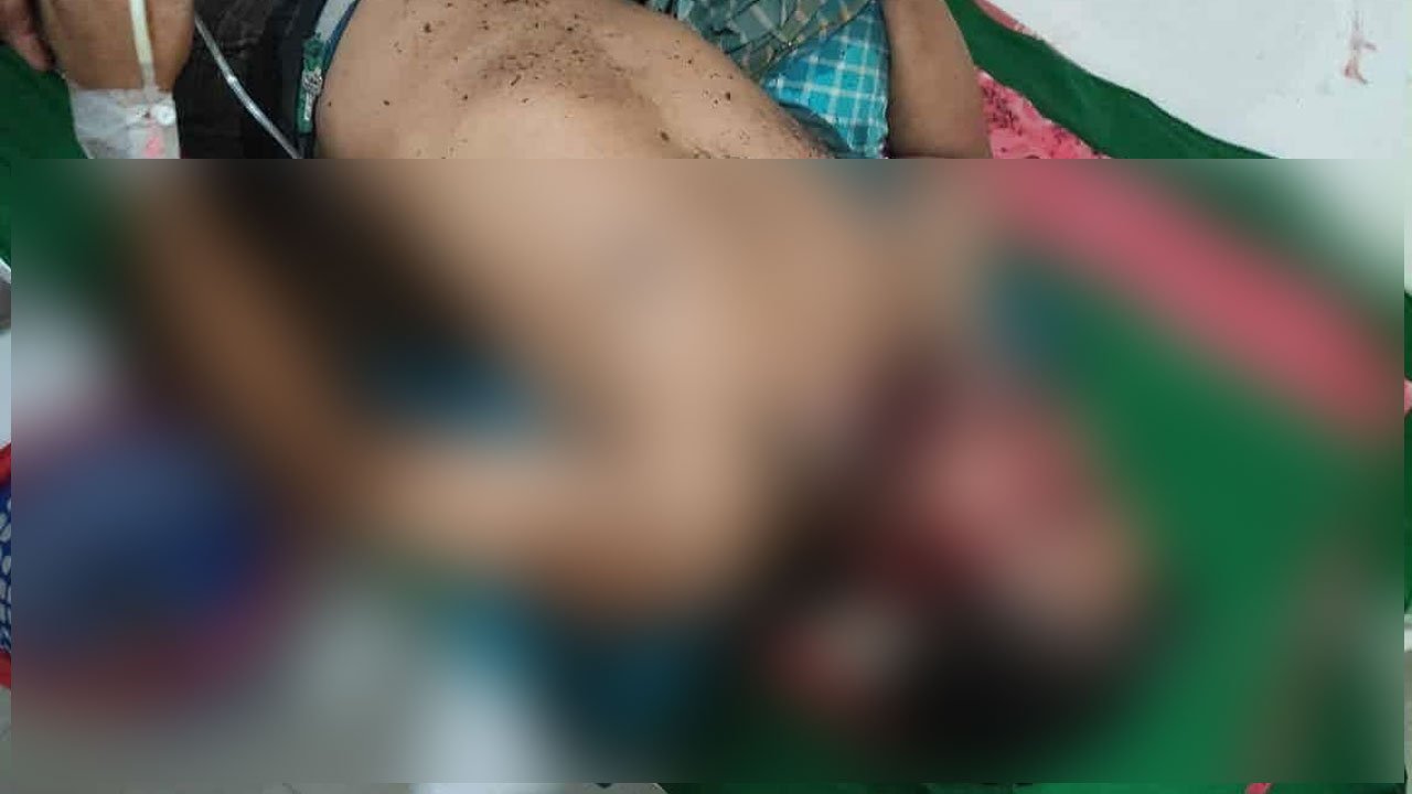 বিকাশ ব্যবসায়ী নয়ন