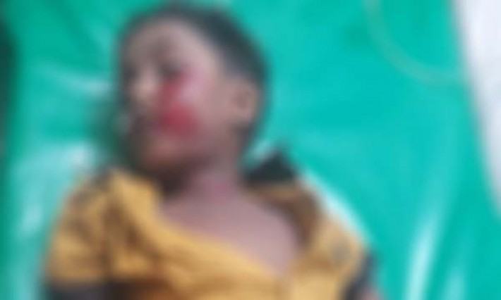 বিরামপুরে অটোরিক্সা চাপায় শিশুর মৃত্যু