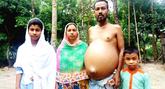 পিতাকে বাঁচাতে সহযোগিতা চাইলো দুই শিশু