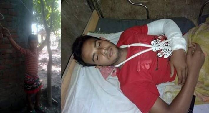 বাকেরগঞ্জে কিশোরকে গাছে বেঁধে নৃশংস নির্যাতন