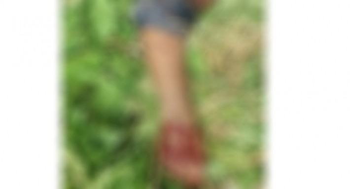 এবার নন্দীগ্রামে বাস যাত্রীর হাত বিচ্ছিন্ন