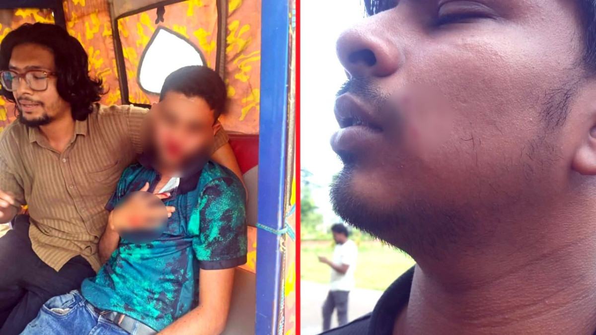 সিকৃবিতে শিক্ষার্থীদের ওপর ছাত্রদলের হামলা, ৭ সদস্যের তদন্ত কমিটি গঠন