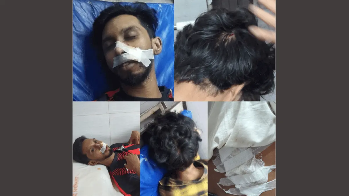 ইবিতে ফুটবল খেলাকে কেন্দ্র করে দফায় দফায় সংঘর্ষ