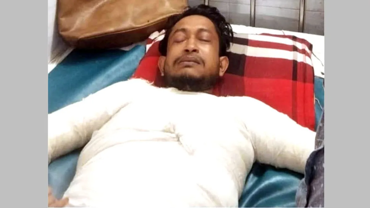 ১৬ দিন ধরে ঢাকার বার্ন ইউনিটে বাগাতিপাড়ার সাব্বির, সহায়তার আকুতি পরিবারের