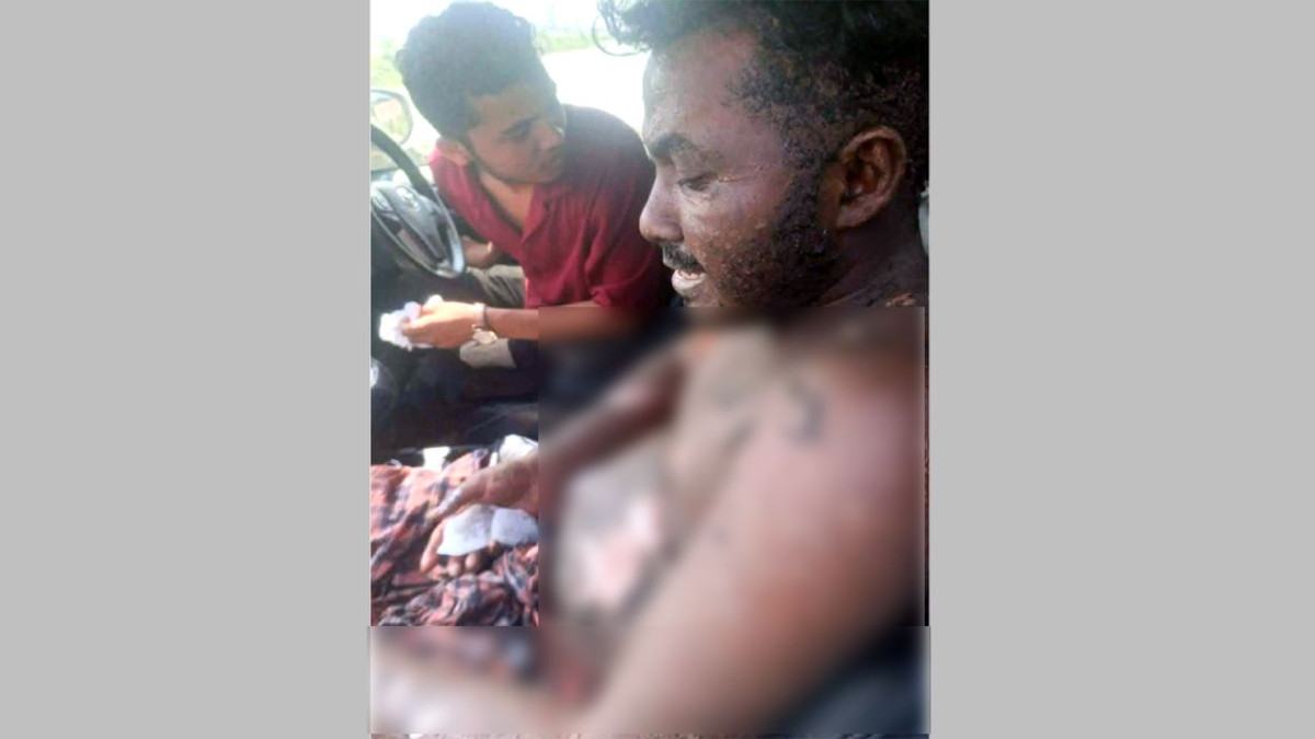 মিরসরাই অর্থনৈতিক অঞ্চলে ফার্মিক স্টিলের ফার্নেসে দুর্ঘটনা, চীনা নাগরিকসহ আহত ৪