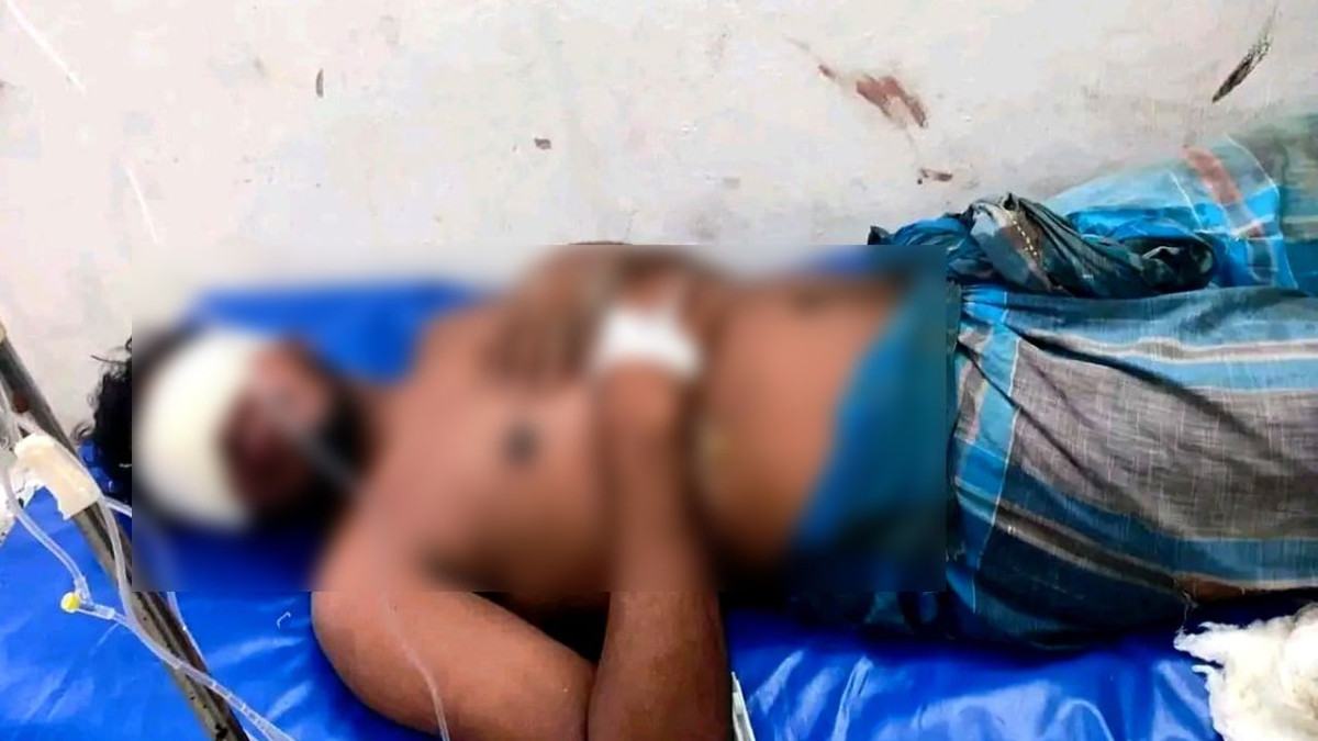 বোরহানউদ্দিনে যুবককে তুলে নিয়ে ২ চোখ নষ্টের অভিযোগ, গ্রেফতার ১