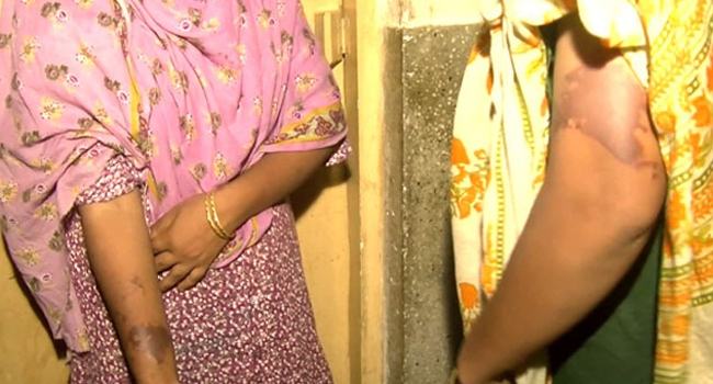 বাড়িতে আশ্রয় নেয়া তরুণকে বাঁচাতে এসিডে ঝলসে গেল ২ নারী