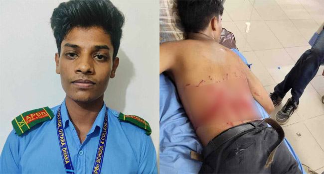 বৈষম্যবিরোধী আন্দোলনে গুলিবিদ্ধ ইলহামের পাশে তারেক রহমান