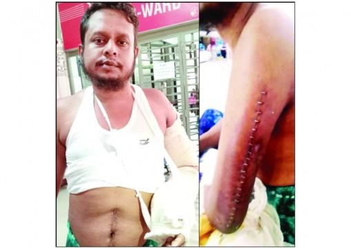 গুলিতে নেসারের বাহুর হাড় টুকরা টুকরা হয়ে গেছে