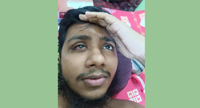 বৈষম্যবিরোধী আন্দোলনে গুলিবিদ্ধ রিয়াদ চিকিৎসার অভাবে কাতরাচ্ছেন