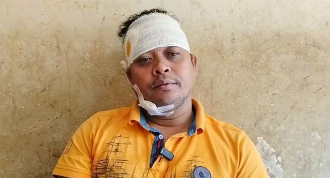 হাতিয়ায় ইরাক প্রবাসীর ওপর সন্ত্রাসী হামলা