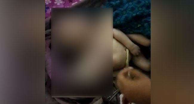 বাগআঁচড়ায় জোড়া মাথার শিশুর জন্ম, দুই ঘণ্টা পর মৃত্যু
