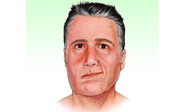 রামসে হান্ট সিন্ড্রোম