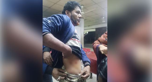 মোটরসাইকেলে এসে কৃষককে গুলি