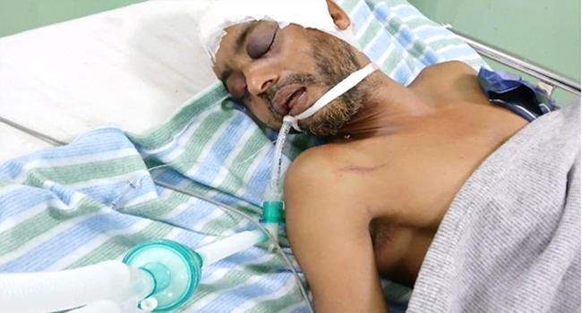 পটিয়ায় সন্ত্রাসী হামলার শিকার আহত সামশুলের মৃত্যু