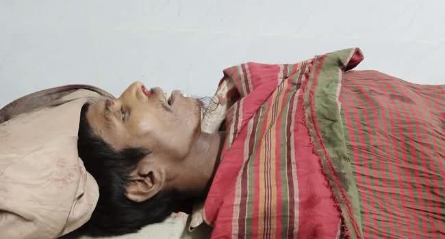শৈলকুপায় বাইকের ধাক্কায় নিহত ১