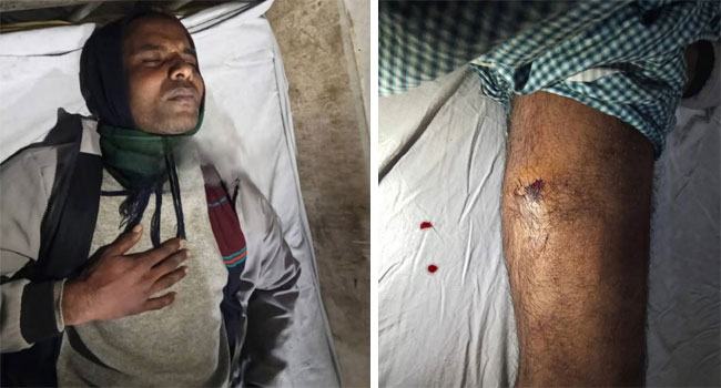 ঈশ্বরদীতে স্বেচ্ছাসেবক দল কর্মী গুলিবিদ্ধ