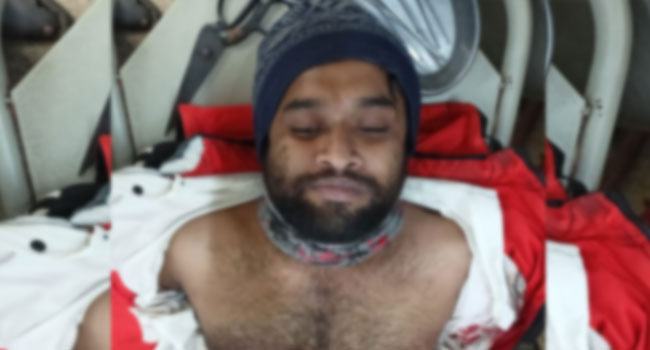 যশোরে শীর্ষ সন্ত্রাসী ১৪ মামলার আসামি ভাইপো রাকিব গুলিবিদ্ধ