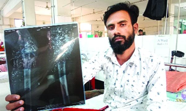 হাসপাতাল ছাড়পত্র না দেয়ায় আর্থিক সহায়তা পাচ্ছেন না রুমেল
