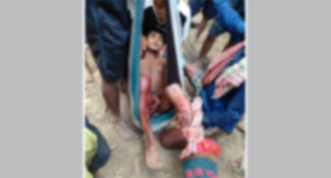 নাইক্ষ্যংছড়ির বাংলাদেশ-মিয়ানমার সীমান্তে ফের মাইন বিস্ফোরণে বাংলাদেশী আহত