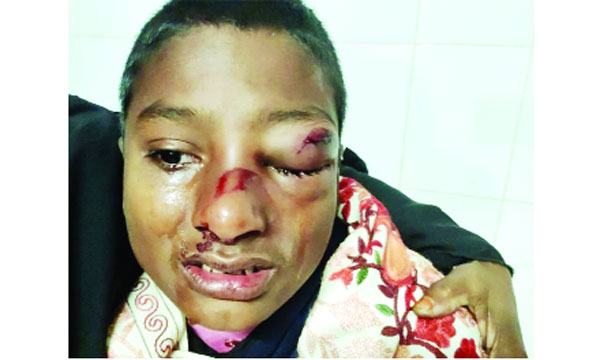 হুজুরের সাইকেল নেয়ায় শিক্ষার্থীকে পিটিয়ে জখম
