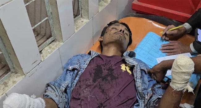 সাঁথিয়ায় ৯ মামলার ওয়ারেন্টভুক্ত যুবকের ২ হাতের কব্জি কেটে নিয়েছে দুর্বৃত্তরা