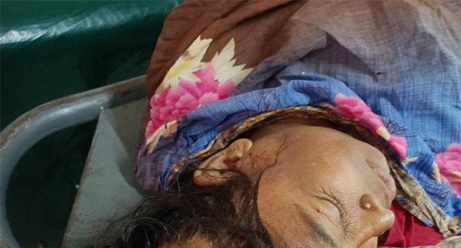 সোনাগাজীতে যুবদলের সাথে যুবলীগের সংঘর্ষে আহত ১০