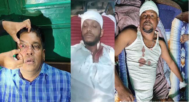 বরগুনার বেতাগীতে দু’গ্রুপের সংঘর্ষ : পুলিশসহ আহত ৩০