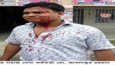 এতিমের টাকা আত্মসাতে সহযোগিতা না করায় সমাজসেবা কর্মকর্তাকে মারধর