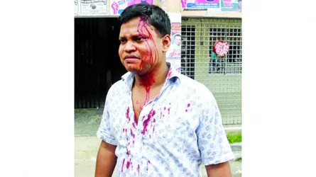মঠবাড়িয়ায় সমাজসেবা কর্মকর্তাকে পিটিয়ে জখম