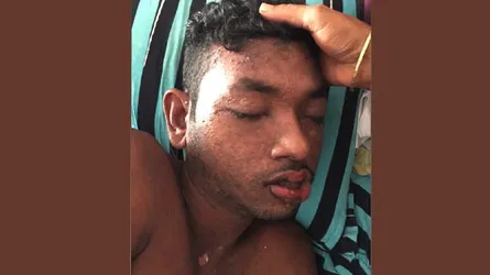 ভুল চিকিৎসায় জীবন মৃত্যুর সন্ধিক্ষণে বাকপ্রতিবন্ধী মেহেদী