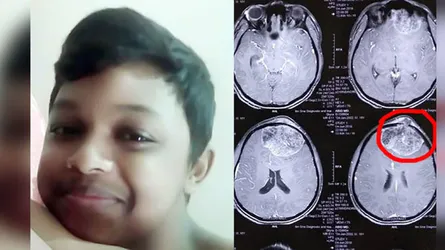 ব্রেন টিউমারে আক্রান্ত শিশু আবিদ বাঁচতে চায়
