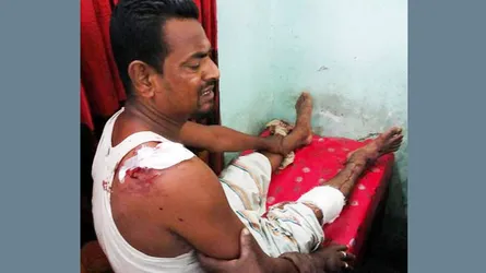 সরিষাবাড়ীতে ভিজিএফ কার্ড না দেয়ায় ইউপি সদস্যকে কুপিয়ে জখম