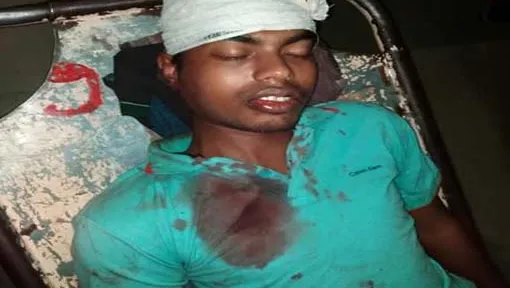 ছাত্রলীগের হামলায় আহত রাবি শিক্ষার্থীর শারীরিক অবস্থার অবনতি