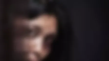 এসিডে ঝলসে গেছে তরুণীর মুখ
