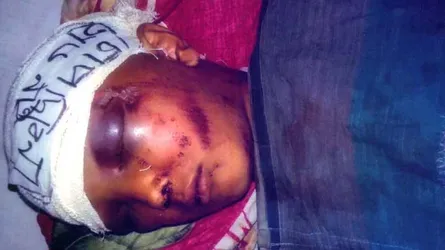 শিশুটিকে বাঁচাতে এগিয়ে আসুন