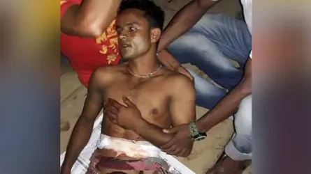 রামদার আঘাতে বাবুল মিয়া মৃত্যুর সাথে পাঞ্জা লড়ছে