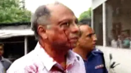 মাহমুদুর রহমানের উপর হামলা : নিউইয়র্ক প্রবাসী সাংবাদিক ও নাগরিক সমাজের উদ্বেগ