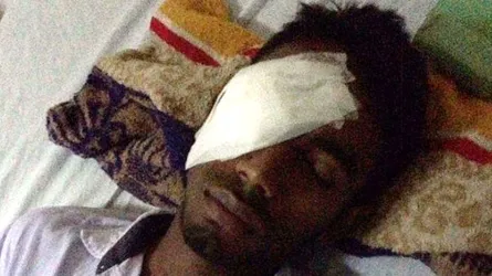 শিক্ষকের বেতের আঘাতে চোখ হারাতে বসেছে আশিকুর
