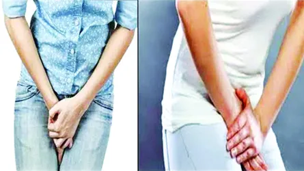প্রস্রাবে জ্বালাপোড়া