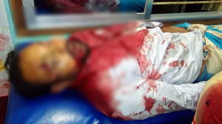 সাতক্ষীরায় ইউপি চেয়ারম্যানকে কুপিয়ে ও গুলি করে হত্যা