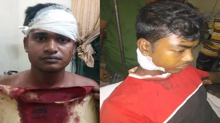 চৌগাছায় প্রতিপক্ষের হামলায় স্বেচ্ছাসেবকলীগ নেতাসহ আহত ৩