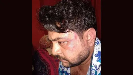 ফেনীতে ছাত্রদল নেতার উপর হামলা