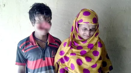 এক যুগ ধরে ভয়ঙ্কর রোগে গৃহবন্দী ভাই-বোন