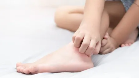 শরীর কেন চুলকায়? চুলকানো কি উচিৎ?