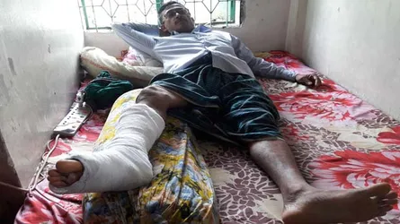 আ’লীগ নেতার পায়ের রগ কাটলেন সন্ত্রাসীরা