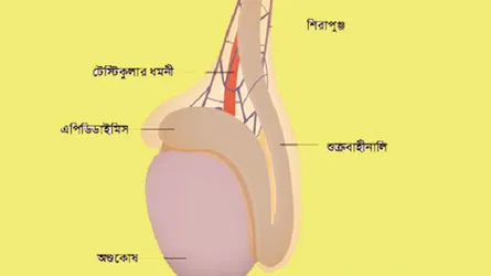 অণ্ডকোষে ব্যথার নানা কারণ
