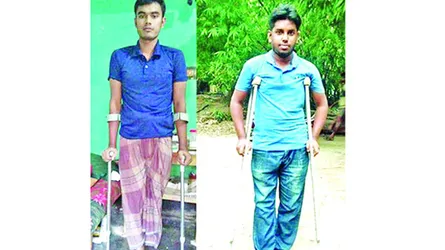 চৌগাছায় দুই তরুণ এখন ক্রাচে ভর দিয়ে চলে