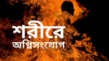চট্টগ্রামে আগুনে দগ্ধ দুজনের মৃত্যু
